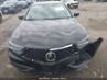 ACURA TLX TECH PACKAGE